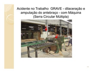 Acidente no Trabalho GRAVE - dilaceração e
amputação do antebraço - com Máquina
(Serra Circular Múltipla)
Painel da Máquina
Botão de Parada
15
 