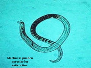 Macho: se pueden apreciar los esticocitos  