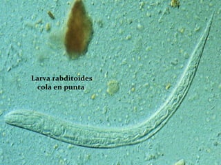 Larva rabditoides cola en punta  