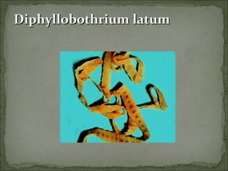 Diphyllobothrium latum 