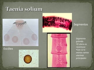 Taenia solium Segmentos  Escólex  Segmento grávido El útero es  racemoso  Con 12 ó menos ramas uterinas principales  