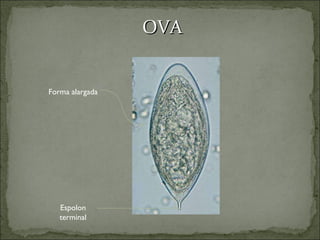 OVA Espolon terminal Forma alargada 