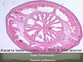 Corte Transversal – Parásito polimiario   