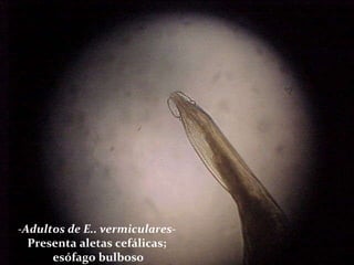 -Adultos de E.. vermiculares-  Presenta aletas cefálicas;  esófago bulboso 