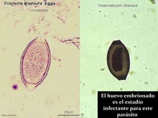 El huevo embrionado es el estadío infectante para este parásito   