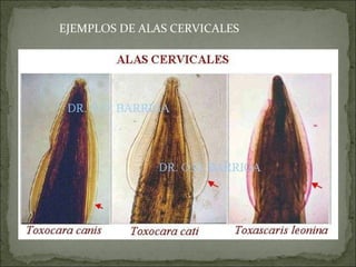 EJEMPLOS DE ALAS CERVICALES 
