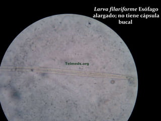 Larva filariforme  Esófago alargado; no tiene cápsula bucal  