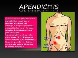 El dolor que se produce con laEl dolor que se produce con la
apendicitis,apendicitis,   comienza acomienza a
sentirse alrededor delsentirse alrededor del
ombligoombligo  y luego va creciendo,y luego va creciendo,
expandiéndose sobre laexpandiéndose sobre la  zonazona
inferior del abdomen, en lainferior del abdomen, en la
parte derecha.parte derecha.
La apendicitis se desarrollaLa apendicitis se desarrolla
entre unas 12 y 18 horas, seentre unas 12 y 18 horas, se
vuelve intensa e insoportable yvuelve intensa e insoportable y
luego de pasado este lapso, seluego de pasado este lapso, se
agrava aún más la situación yagrava aún más la situación y
se vuelve peligrosa.se vuelve peligrosa.
 
