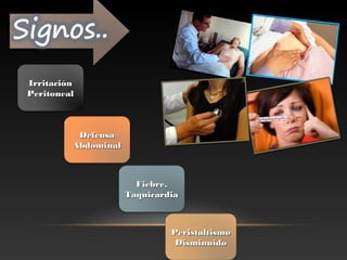 IrritaciónIrritación
PeritonealPeritoneal
DefensaDefensa
AbdominalAbdominal
Fiebre,Fiebre,
TaquicardiaTaquicardia
PeristaltismoPeristaltismo
DisminuidoDisminuido
 