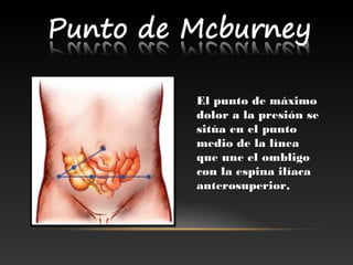 El punto de máximoEl punto de máximo
dolor a la presión sedolor a la presión se
sitúa en el puntositúa en el punto
medio de la líneamedio de la línea
que une el ombligoque une el ombligo
con la espina ilíacacon la espina ilíaca
anterosuperior,anterosuperior,
 