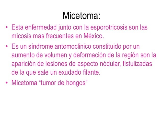Al miembro aumentar las casas