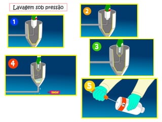 Lavagem sob pressão 