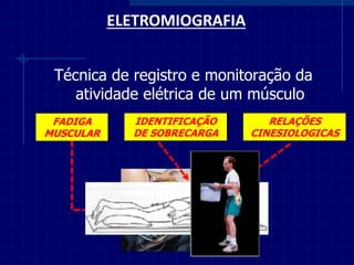 ELETROMIOGRAFIA 
Técnica de registro e monitoração da atividade elétrica de um músculo 
FADIGA MUSCULAR 
IDENTIFICAÇÃO DE SOBRECARGA 
RELAÇÕES CINESIOLOGICAS  