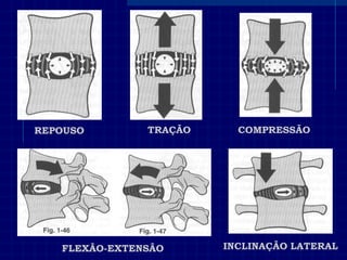REPOUSO 
TRAÇÃO 
COMPRESSÃO 
FLEXÃO-EXTENSÃO 
INCLINAÇÃO LATERAL  