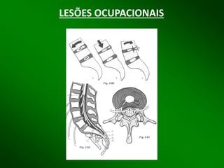 LESÕES OCUPACIONAIS  
