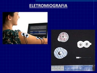 ELETROMIOGRAFIA  