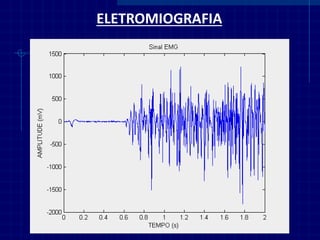 ELETROMIOGRAFIA  