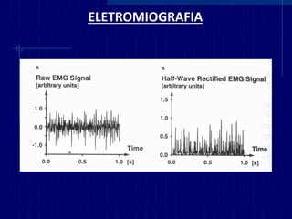 ELETROMIOGRAFIA  