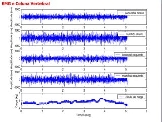0 1 2 3 4 5 6 
-1000 
0 
1000 
Amplitude (mv) 
ileocostal direito 
0 1 2 3 4 5 6 
-1000 
0 
1000 
Amplitude (mv) 
multífido direito 
0 1 2 3 4 5 6 
-1000 
0 
1000 
Amplitude (mv) 
ilecostal esquerdo 
0 1 2 3 4 5 6 
-1000 
0 
1000 
Amplitude (mv) 
multífido esquerdo 
0 1 2 3 4 5 6 
4 
6 
8 
Tempo (seg) 
Carga (kg) 
célula de carga 
EMG e Coluna Vertebral 
 