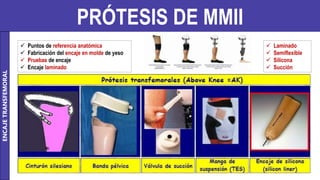 PRÓTESIS DE MMII
ENCAJE
TRANSFEMORAL
 Puntos de referencia anatómica
 Fabricación del encaje en molde de yeso
 Pruebas de encaje
 Encaje laminado
 Laminado
 Semiflexible
 Silicona
 Succión
 