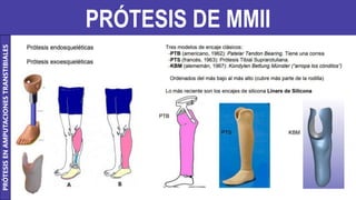 PRÓTESIS DE MMII
PRÓTESIS
EN
AMPUTACIONES
TRANSTIBIALES
 