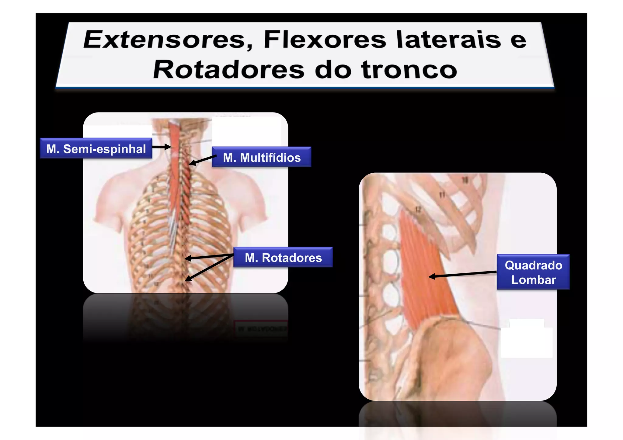 M. Semi-espinhal
M. Multifídios
M. Rotadores
Quadrado
Lombar
 