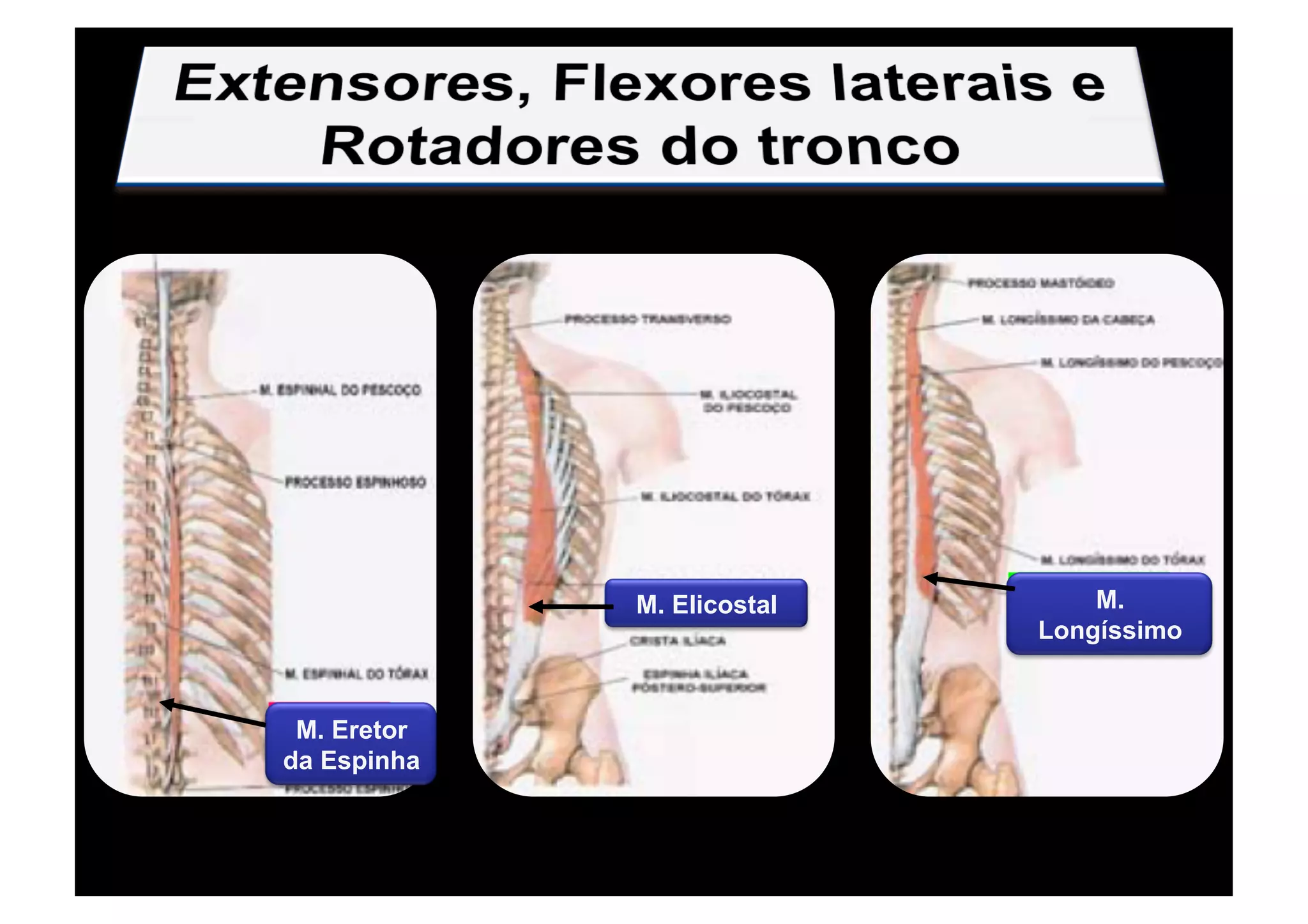 M. Eretor
da Espinha
M. Elicostal M.
Longíssimo
 