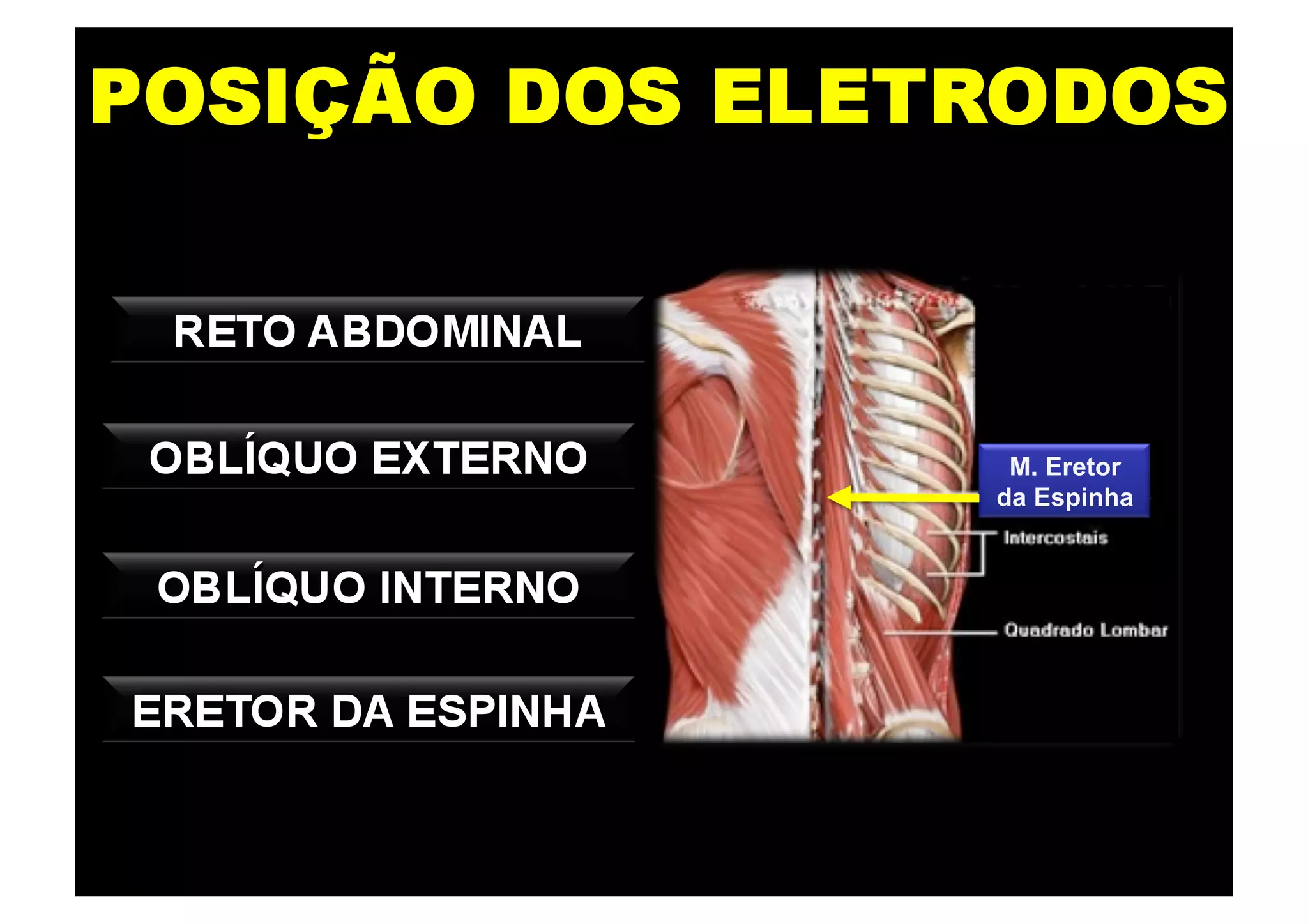 M. Eretor
da Espinha
 