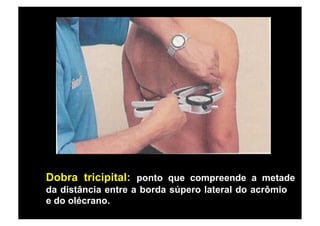 Dobra tricipital: ponto que compreende a metade
da distância entre a borda súpero lateral do acrômio
e do olécrano.
 