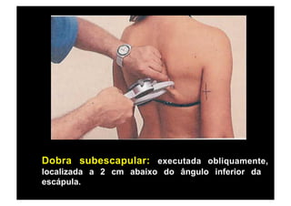 Dobra subescapular: executada obliquamente,
localizada a 2 cm abaixo do ângulo inferior da
escápula.
 