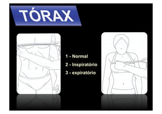 1 - Normal
2 - Inspiratório
3 - expiratório
 