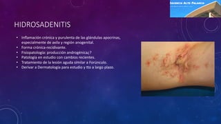 HIDROSADENITIS
• Inﬂamación crónica y purulenta de las glándulas apocrinas,
especialmente de axila y región anogenital.
• Forma crónica-recidivante.
• Fisiopatología: producción androgénica¿?
• Patología en estudio con cambios recientes.
• Tratamiento de la lesión aguda similar a Forúnculo.
• Derivar a Dermatología para estudio y Fo a largo plazo.
 