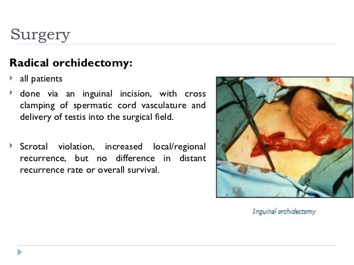 ldh assay