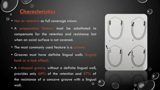 Characteristics
• Not as retentive as full coverage crown.
• A preparation feature must be substituted to
compensate for the retention and resistance lost
when an axial surface is not covered.
• The most commonly used feature is a groove.
• Grooves must have definite lingual walls (lingual
hook or a lock effect).
• A v-shaped groove, without a definite lingual wall,
provides only 68% of the retention and 57% of
the resistance of a concave groove with a lingual
wall.
 