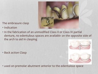 removable Partial denture | PPTX