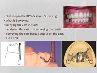 Surveying Rpd removable Partial denture | PPTX