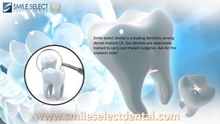 Smile Select Dental is a leading dentistry serving
dental implant CA. Our dentists are extensively
trained to carry out implant surgeries. Ask for the
implants now!
 