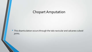 Chopart Amputation
• This disarticulation occurs through the talo navicular and calcaneo cuboid
joints.
 