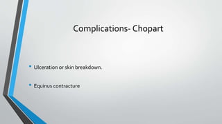 Complications- Chopart
• Ulceration or skin breakdown.
• Equinus contracture
 