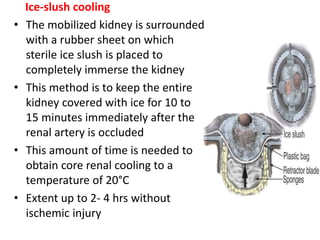 Ice-slush cooling
• The mobilized kidney is surrounded
with a rubber sheet on which
sterile ice slush is placed to
completely immerse the kidney
• This method is to keep the entire
kidney covered with ice for 10 to
15 minutes immediately after the
renal artery is occluded
• This amount of time is needed to
obtain core renal cooling to a
temperature of 20°C
• Extent up to 2- 4 hrs without
ischemic injury
 