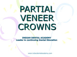 PARTIALPARTIAL
VENEERVENEER
CROWNSCROWNS
INDIAN DENTAL ACADEMYINDIAN DENTAL ACADEMY
Leader in continuing Dental EducationLeader in continuing Dental Education
www.indiandentalacademy.com
 