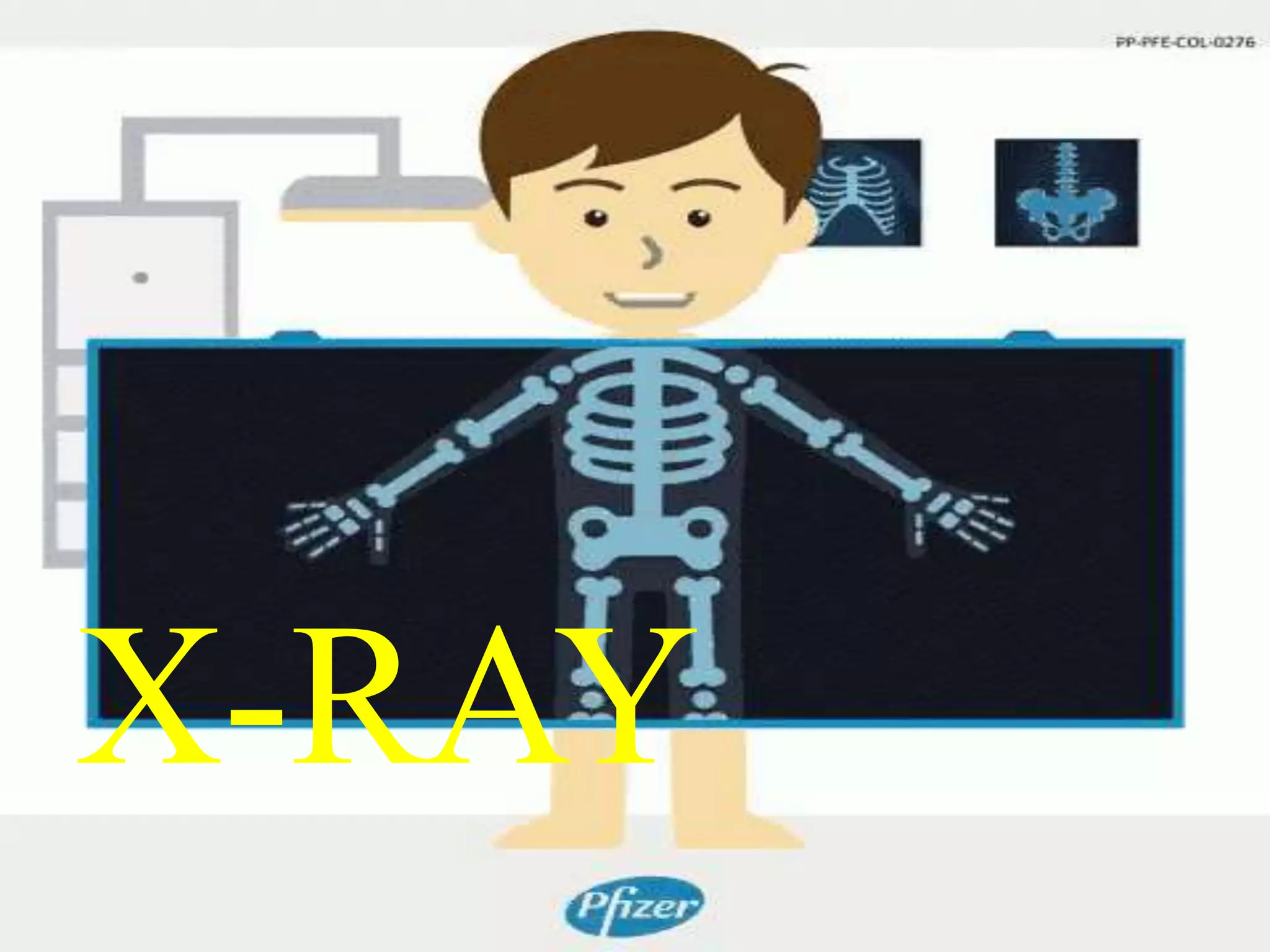 X-RAY
 