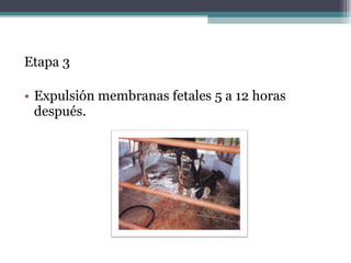 Etapa 3
• Expulsión membranas fetales 5 a 12 horas
después.
 
