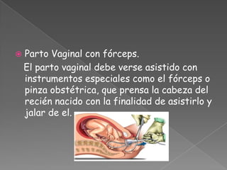 Parto Vaginal con fórceps.<br />   El parto vaginal debe verse asistido con instrumentos especiales como el fórceps o pinz...