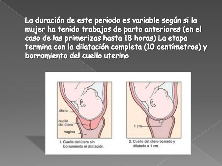 Como criar la proteína para el adelgazamiento para las muchachas