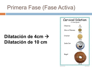 Primera Fase (Fase Activa)




Dilatación de 4cm 
Dilatación de 10 cm
 