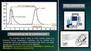 Parametros de la contraccion
TOCOGRAFIA
Se considera que el parto se inicia cuando existe una
dinámica rítmica, progresiva y dolorosa, con un mínimo de 2
contracción uterinas de mediana intensidad cada 10min, con cuello
borrado en mas de 50% y con 2 cm de dilatación.
IMPORTANTE: Se requiere en promedio de 1315mmHg en nulíparas y de
350mmHg en multíparas para expulsar el feto.
 