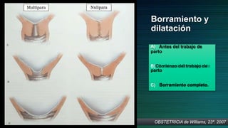 Borramiento y
dilatación
A) Antes del trabajo de
parto
B)Comienzo del trabajo de
parto
C) Borramiento completo.
Multipara Nulipara
OBSTETRICIA de Williams, 23ª. 2007
 