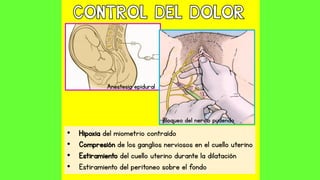 Anestesia epidural
Bloqueo del nervio pudendo
• Hipoxia del miometrio contraído
• Compresión de los ganglios nerviosos en el cuello uterino
• Estiramiento del cuello uterino durante la dilatación
• Estiramiento del peritoneo sobre el fondo
 