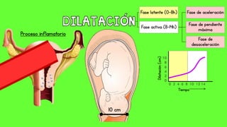 10 cm
Fase latente (0-8h)
Fase activa (8-14h)
Fase de aceleración
Fase de pendiente
máxima
Fase de
desaceleración
Proceso inflamatorio
10
8
6
4
2
0
Tiempo
0 2 4 6 8 10 12 14
Dilatación(cm)
 